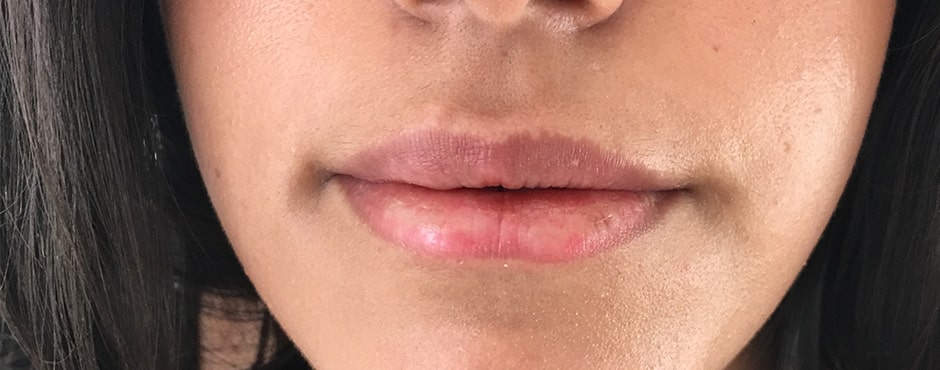 August Lips 3 Before