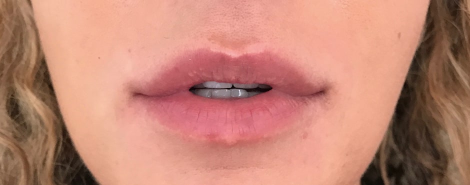 Sian Dellar Portfolio Lips 8 Before